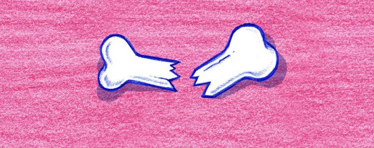 ROKEN is dodelijk broken bones